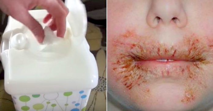 Врачи предупреждают: никогда не вытирайте кожу своих детей детскими влажными салфетками