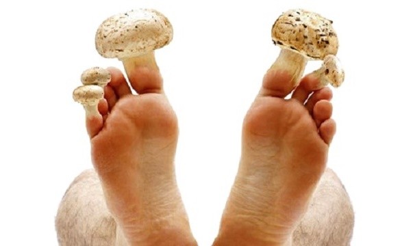 Всего 2 простых ингредиента помогут забыть о грибке ногтей