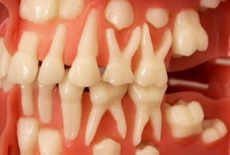 Как вырастить новые зубы самому за 9 недель: невероятное открытие профессора стоматологии