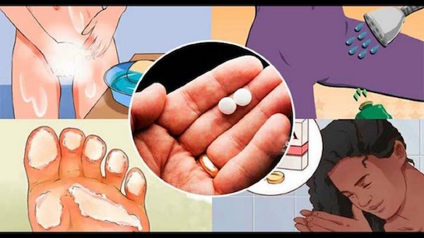 10 трюков с аспирином, которые должна знать каждая женщина. Это изменит вашу жизнь!
