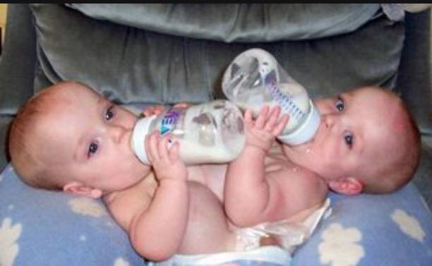 Родители отказались от сиамских близняшек и их сестры, поскольку не могли о них заботиться