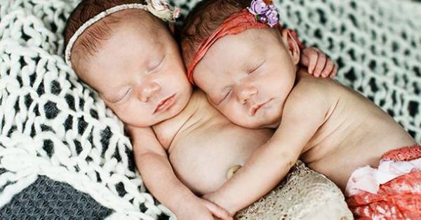 Помните этих близнецов, которые держались за руки при рождении? Посмотрите на них сегодня!