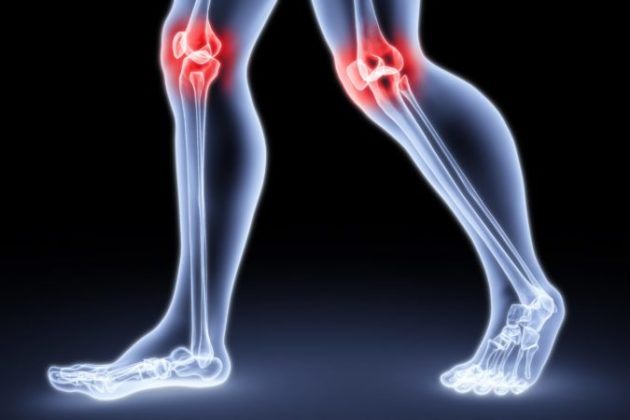 Простейший рецепт из 4 ингредиентов лечит боль в коленях, суставах и регенерирует кости!