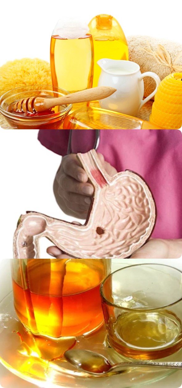 Народные рецепты лечения желудочно-пищевого тракта