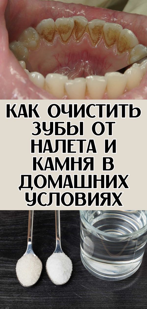 Как очистить зубы от налета и камня в домашних условиях